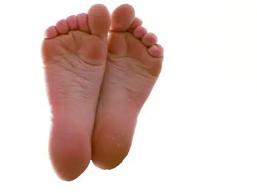 small wrinkled soles